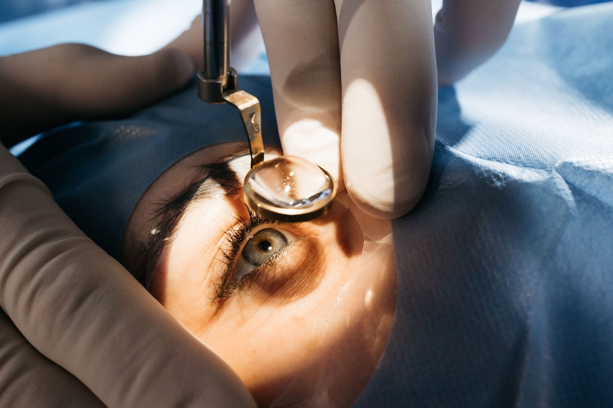 LASIK eye surgery claims